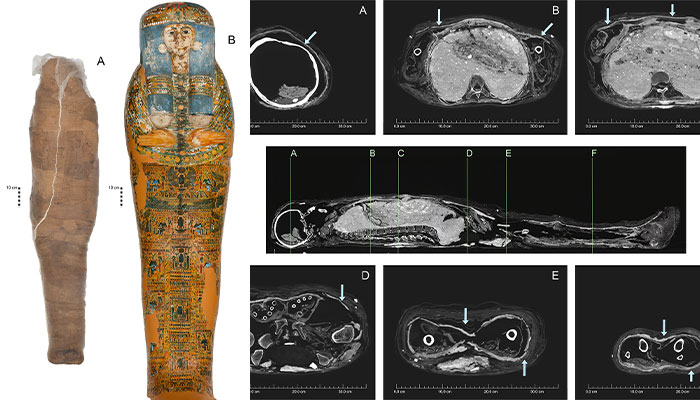 Aufnahmen der Mumie, die in einen "Schlamm-Panzer" gehüllt wurde, sowie die CT-Aufnahmen der Mumie. Die CT-Aufnahmen zeigen jeweils den Querschnitt des Kopfes, der Brust, des Magens, des Beckens sowie zwei Abschnitte der Beine.