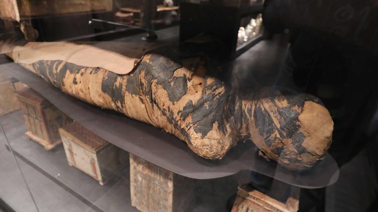 Die Mumifizierte Frau im Nationalmuseum in Warschau könnten an Krebs verstorben sein. 