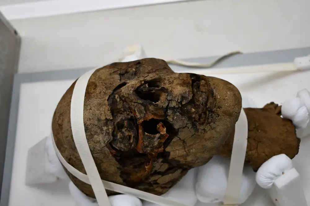 Das Foto zeigt den abgetrennten Kopf der ägyptischen Mumie, die in Kent auf einem Dachboden gefunden wurde.