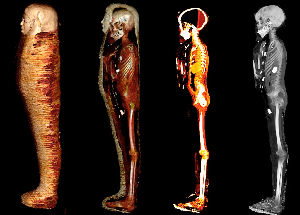 Zu sehen ist der sog. Goldjunge. Vier Scans zeigen den Aufbau der Mumie jeweils im Profil. 1. Der komplette Sarkophag; 2. Querschnitt durch den Sarkophag und die Mumien; 3. Querschnitt durch die Mumie; 4. Röntgenbild der Mumie. Die goldenen Beigaben sind hell hervorgehoben.